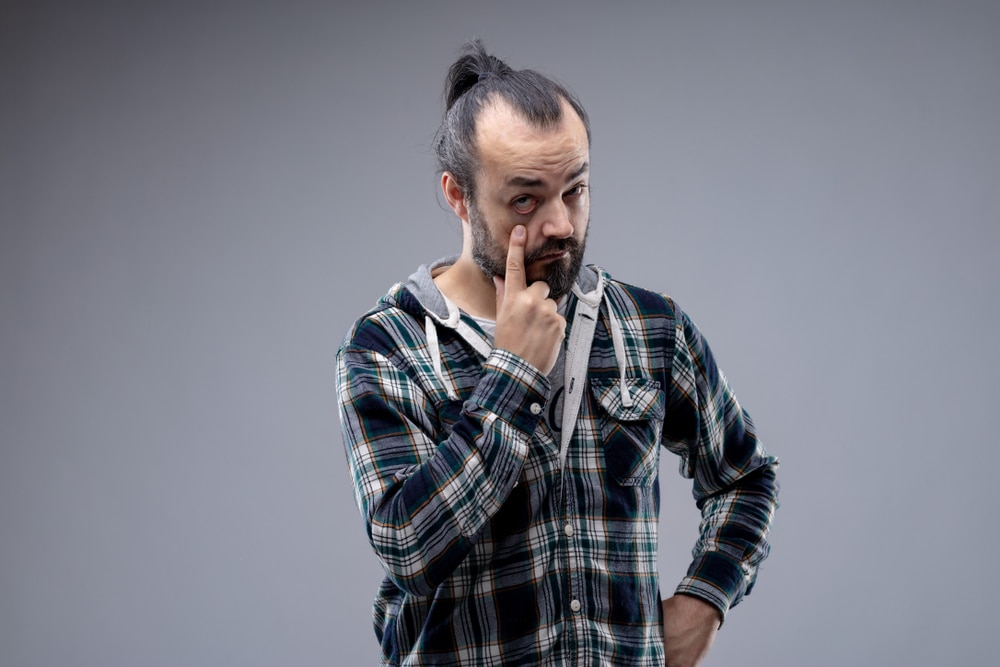 man pulling his lower eyelid down